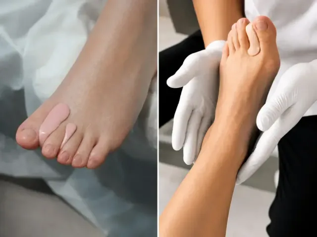 Orteze individuale din silicon - Podiatry service