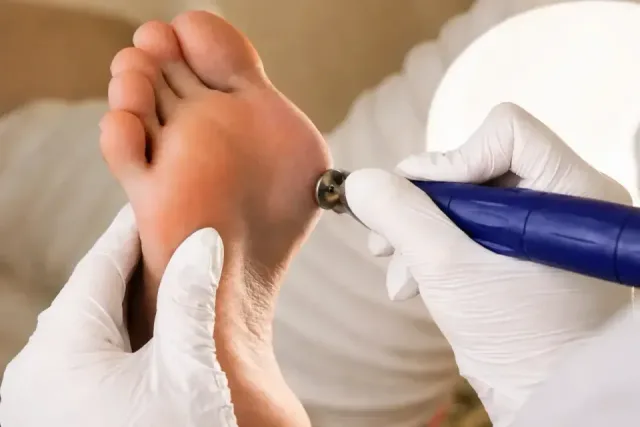 Îngrijire podologică medicală - Podiatry service