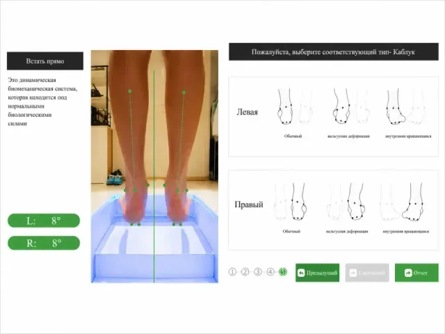 Diagnosticul structurii osoase și al biomecanicii piciorului - 2